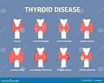 Did Chernobyl Cause Thyroid Problems?