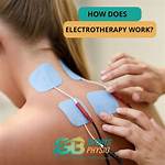 Did Electrotherapy Ever Work?