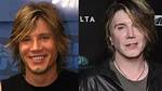 Did Goo Goo Dolls Lead Singer John Rzeznik Has Undergone Plastic Surgery? Here Is What We Know
