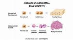 Do Abnormal Cells Go Away?