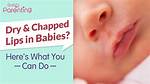 Do Babies Lips Get Chapped?