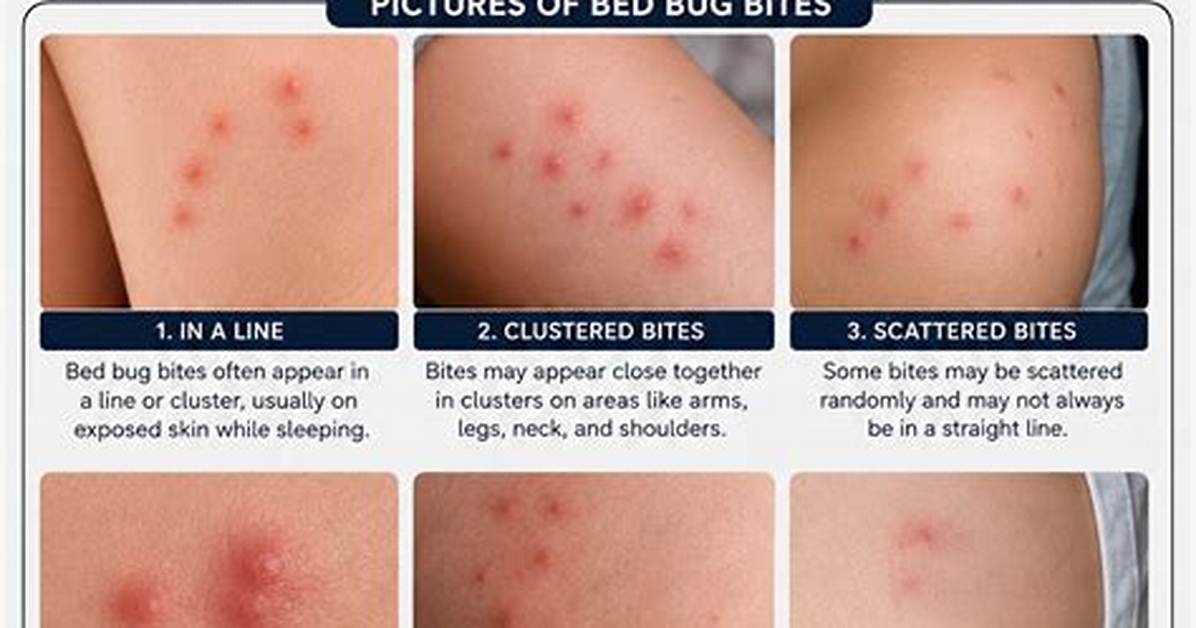 Do Bed Bugs Die When They Bite You?