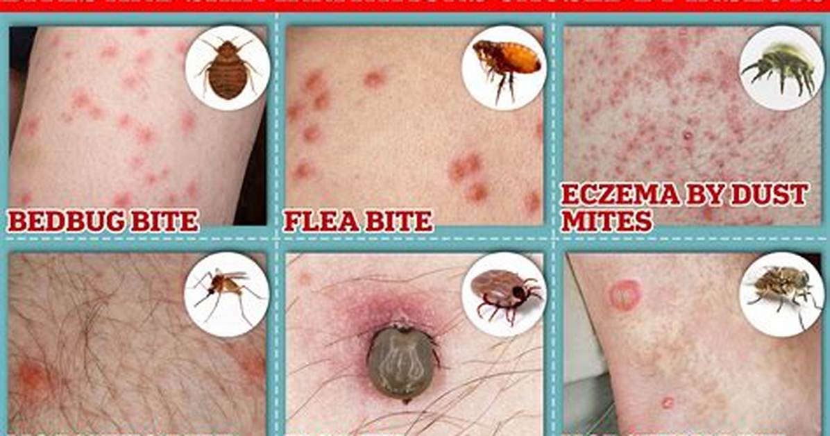 Do Bed Mites Bite