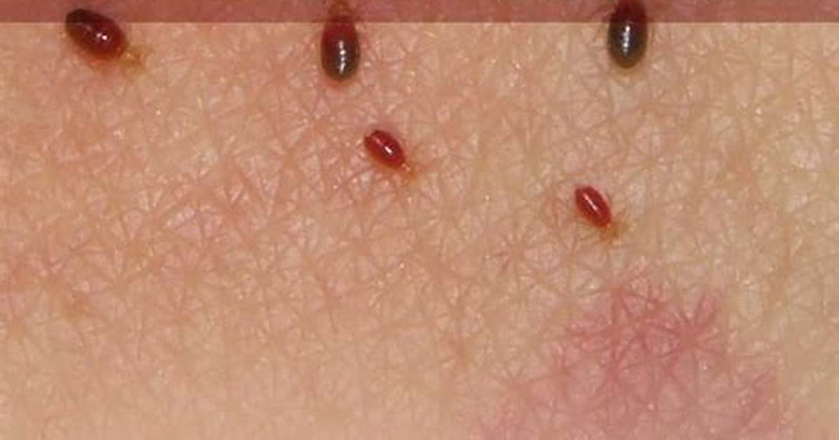 Do Bedbugs Bite Every Night?