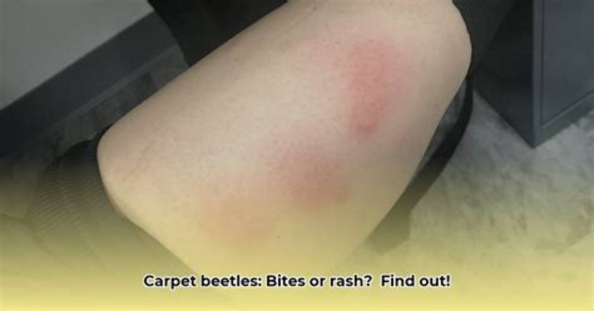 Do Black Clock Beetles Bite