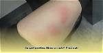 Do Black Clock Beetles Bite
