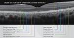 Do Boots Opticians Do Oct Scans?