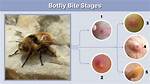 Do Botfly Bites Itch?