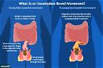 Do Bowels Stop Working Before Death?