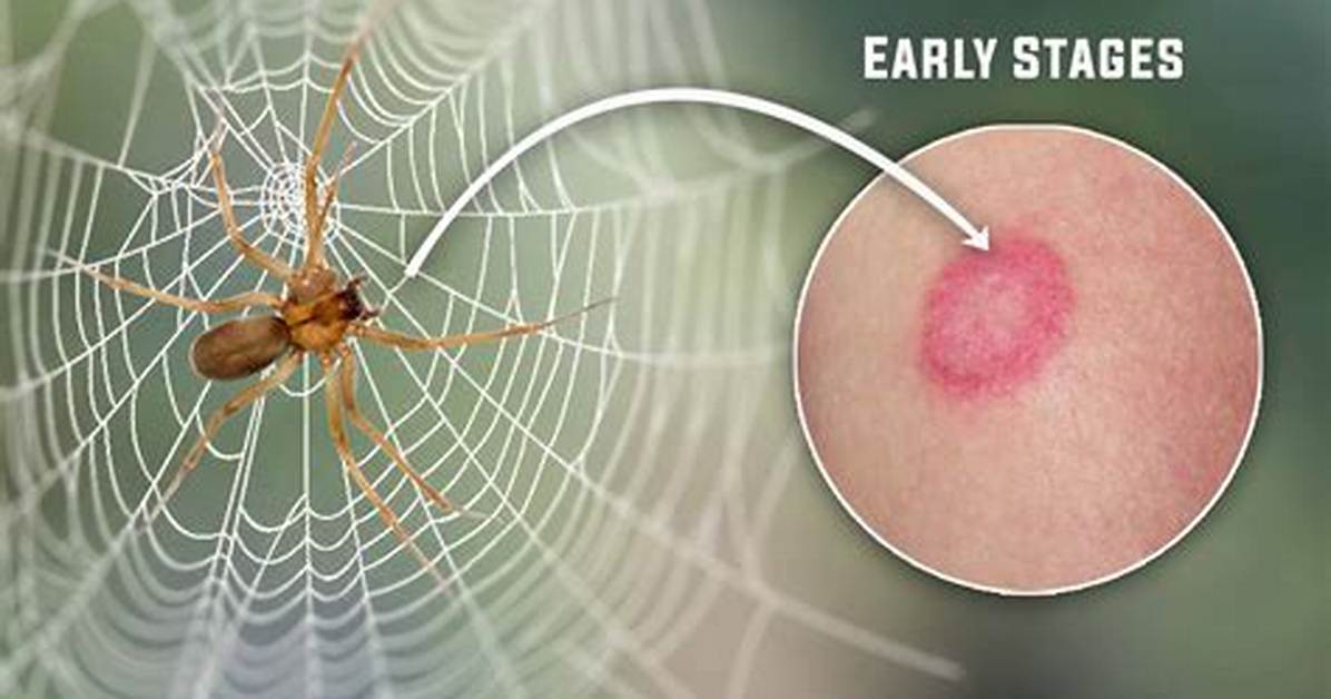 Do Brown Spiders Bite