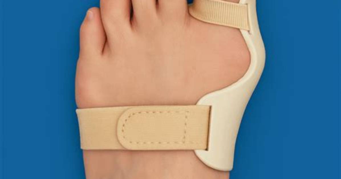 Do Bunion Splints Work?