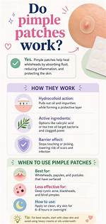 Do Buzz Patches Work?