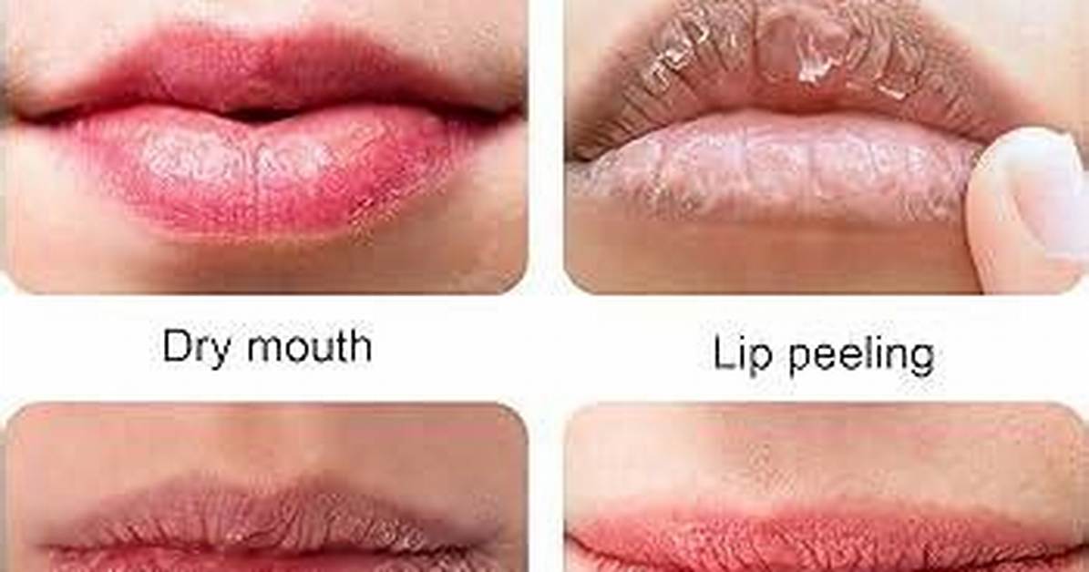 Do Chapped Lips Look Smaller?