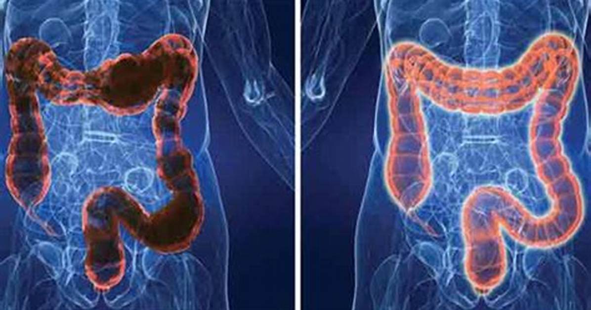 Do Colonics Hurt?