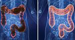 Do Colonics Hurt?