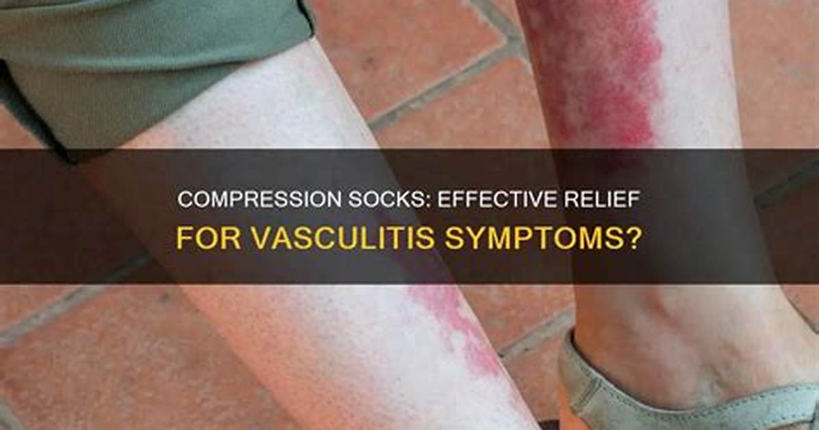 Do Compression Socks Help Vasculitis?
