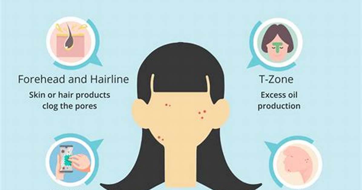 Do Concealer Cause Breakouts?