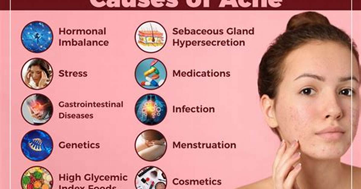 Do Curd Cause Acne?
