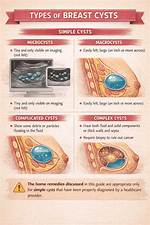 Do Cysts Change Size?
