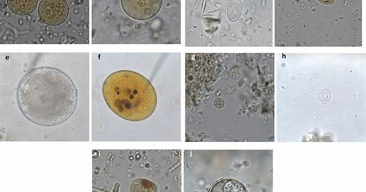 Do Cysts Flagella