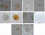 Do Cysts Flagella