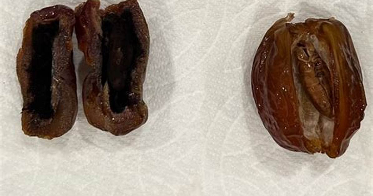 Do Dates Go Bad?
