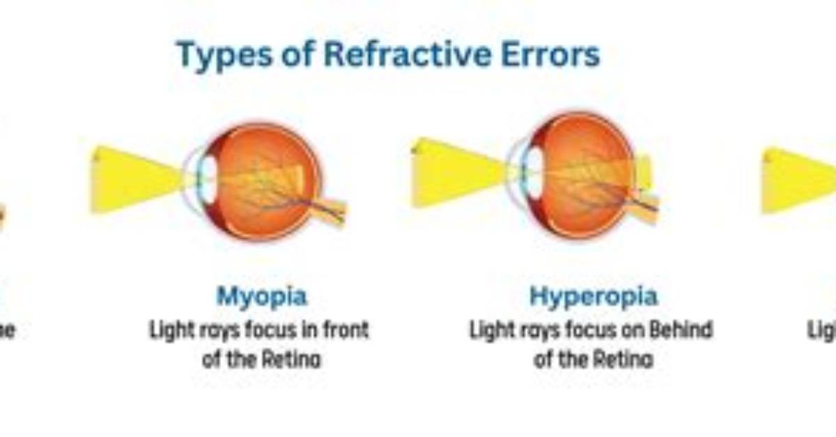 Do Dogs Have Refractive Errors?