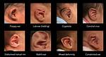 Do Ear Deformities Correct Themselves?