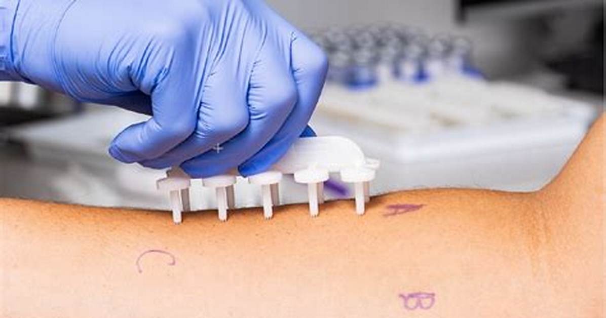 Do Ent Doctors Do Allergy Testing?