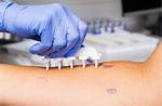Do Ent Doctors Do Allergy Testing?