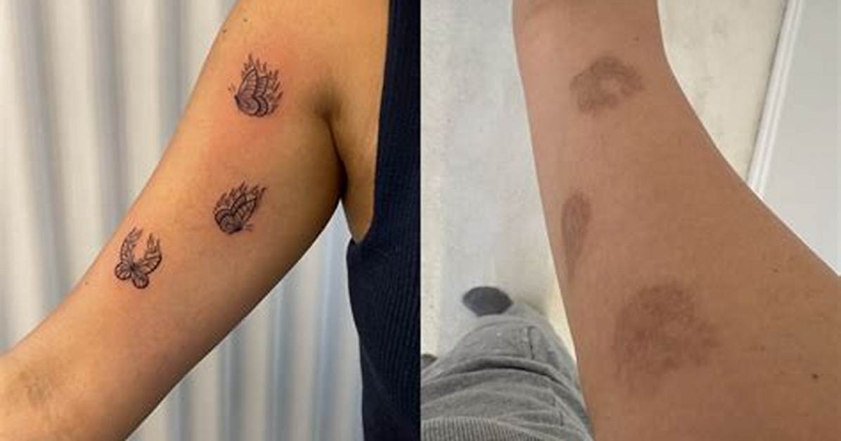 Do Etching Tattoos Last?