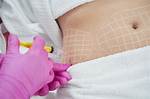 Do Fat Reducing Injections Work?