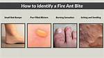 Do Fire Ants Bite or Sting?