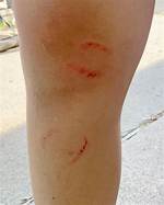 Do Fish Bite Twice?
