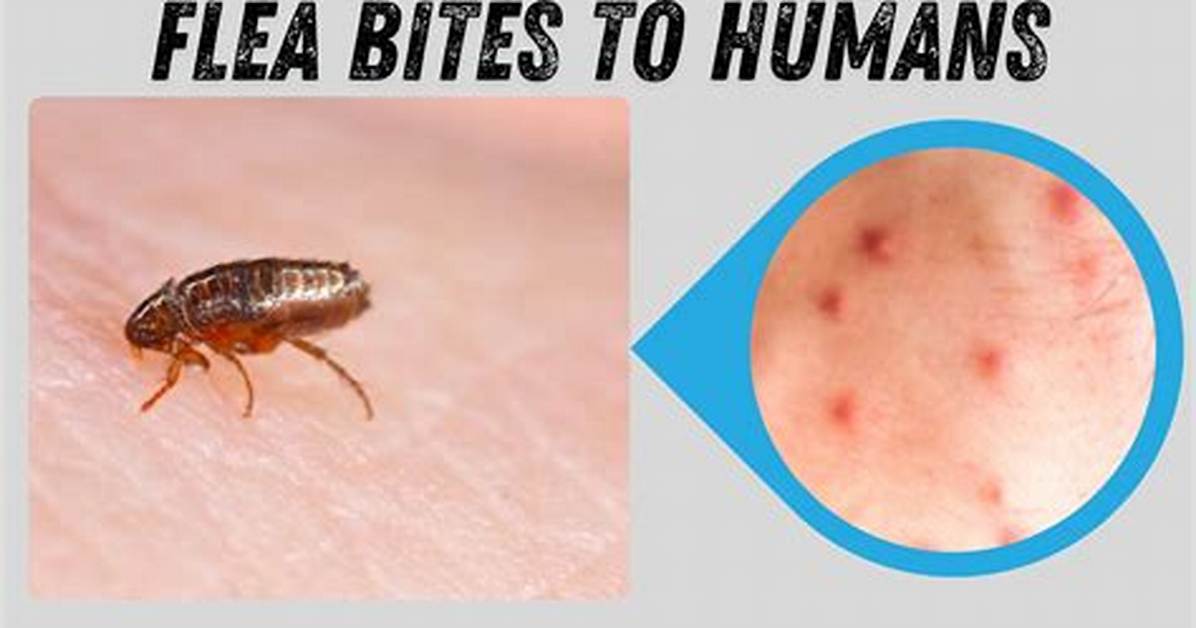 Do Fleas Bite Human Scalps?