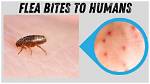 Do Fleas Bite Human Scalps?