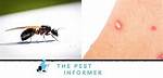 Do Flying Fire Ants Bite?