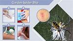 Do Garden Spiders Bite?
