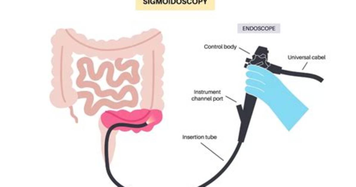 Do Gastroenterologists Do Sigmoidoscopy?