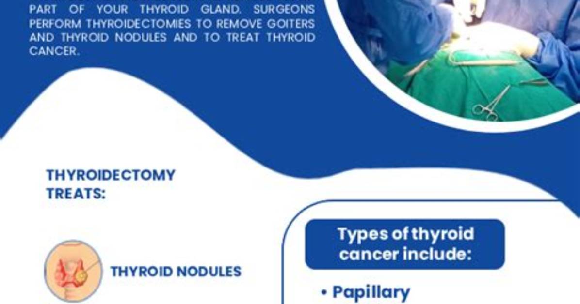 Do General Surgeons Do Thyroidectomies?