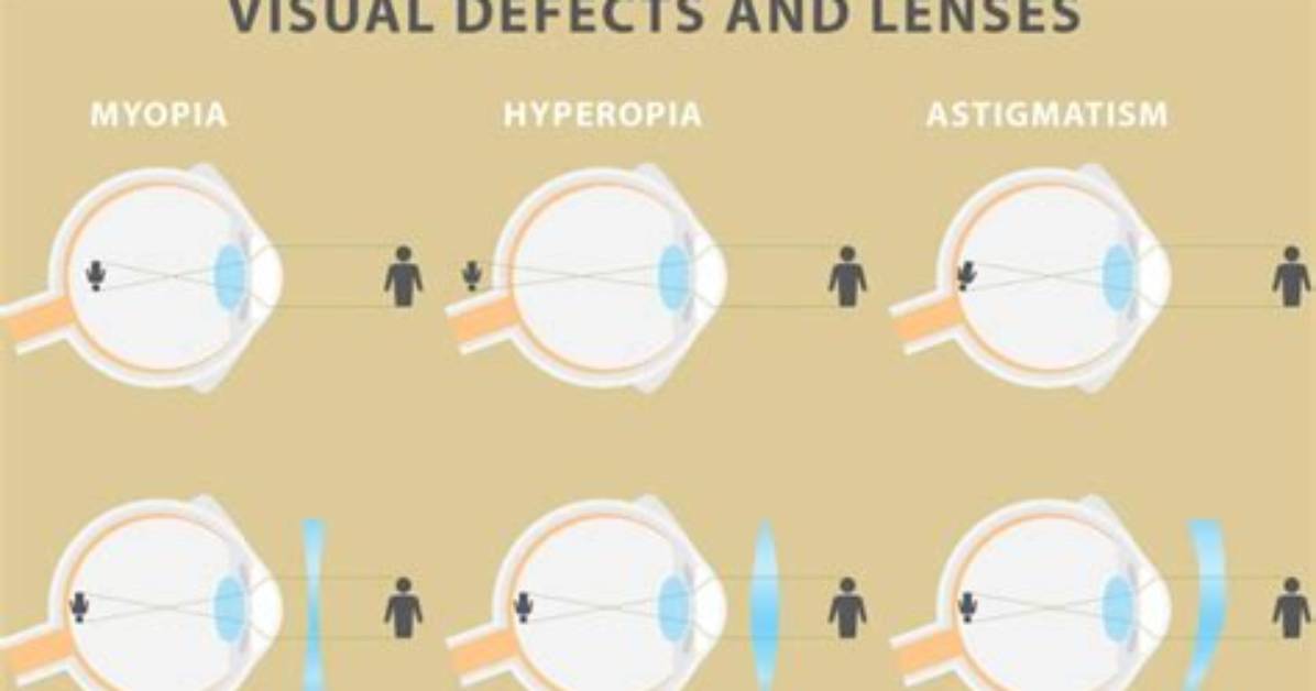 Do Glasses Help with Hyperopia?