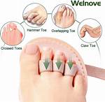 Do Hammer Toe Correctors Work?