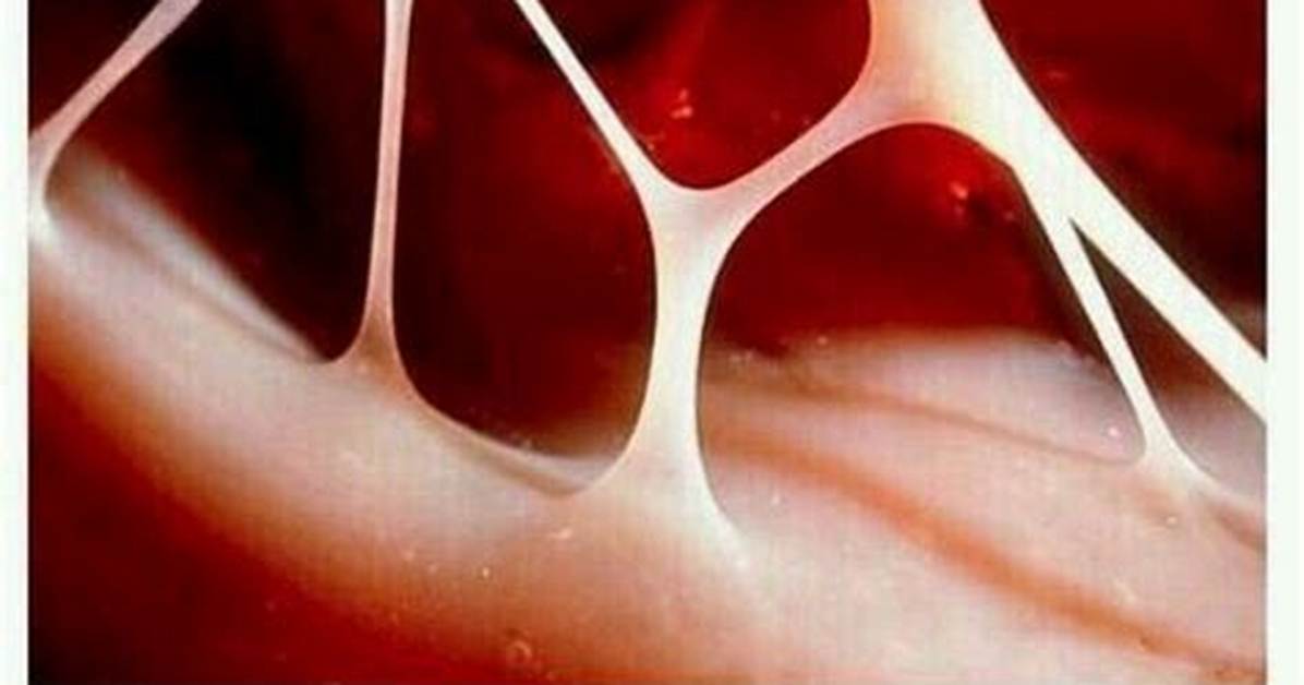 Do Heartstrings Really Break?