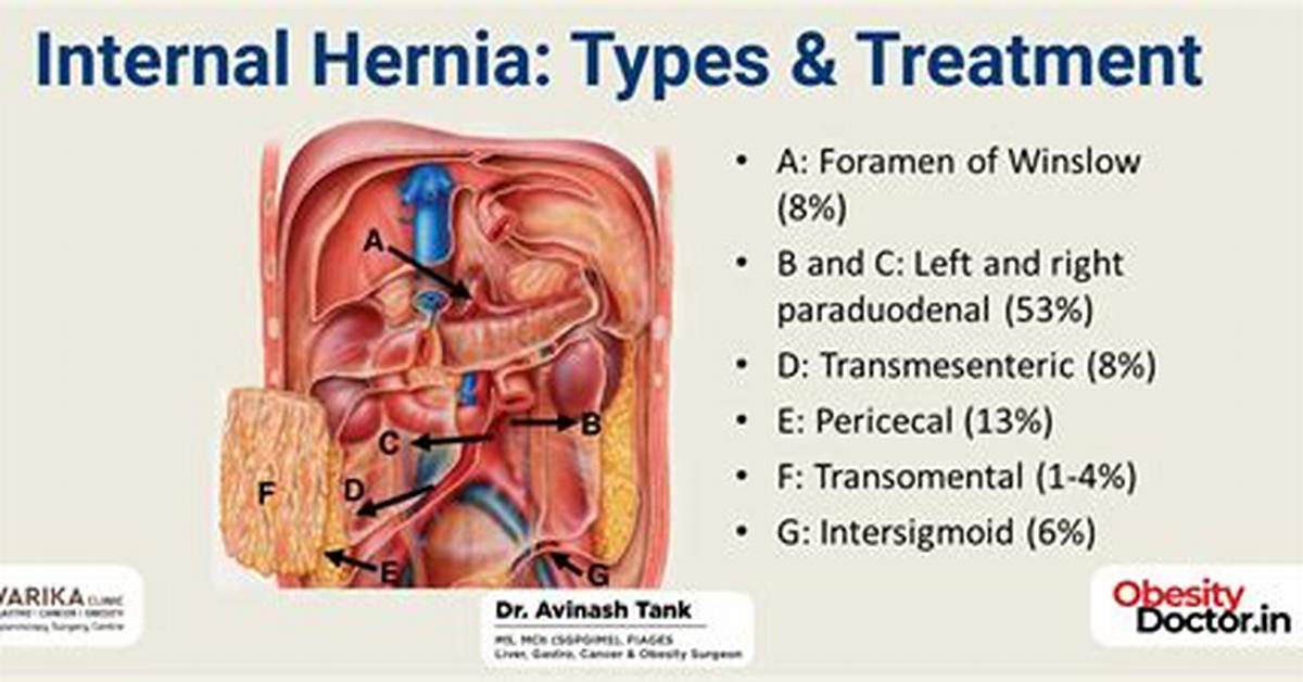 Do Hernias Bleed Internally?