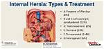 Do Hernias Bleed Internally?