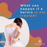 Do Hernias Disappear