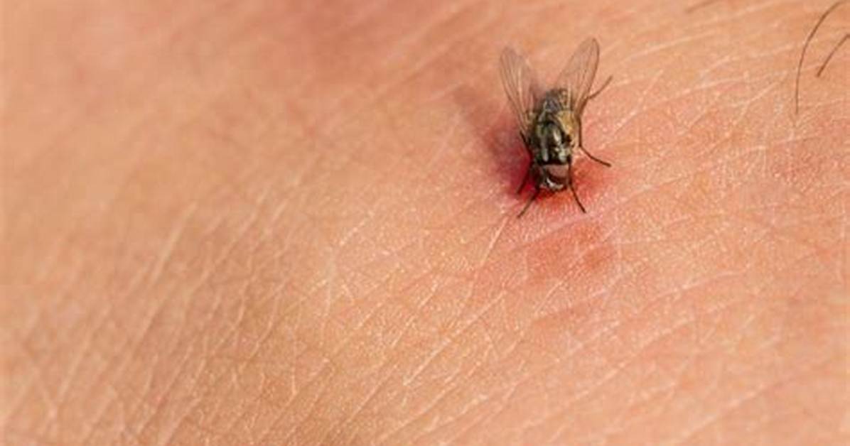 Do House Flies Bite