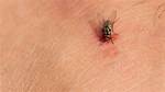 Do House Flies Bite