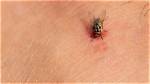 Do House Fly Bite?