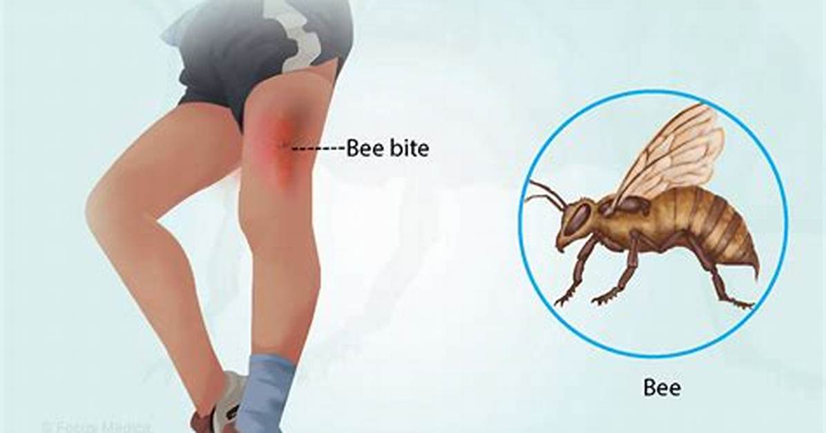 Do Hover Bees Sting?